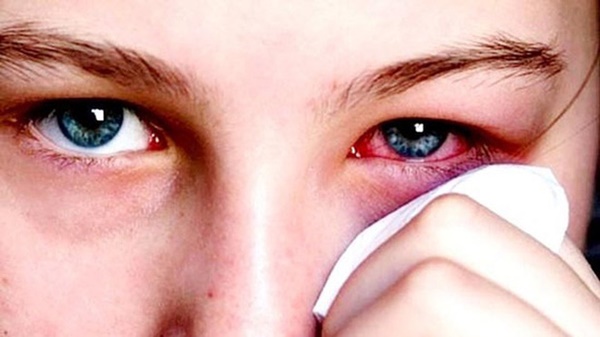 Người sắp mắc bệnh ung thư thường có 3 dấu hiệu kỳ lạ ở mắt: Làm ngơ sẽ khiến bệnh tiến triển nặng và bào mòn tuổi thọ-4