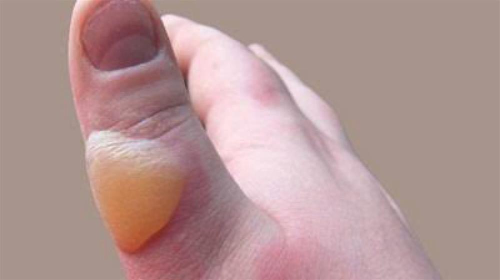 Củ khoai tây hỏng đem đặt cạnh máy hút mùi có thể giải quyết vấn đề lớn của mọi nhà-4