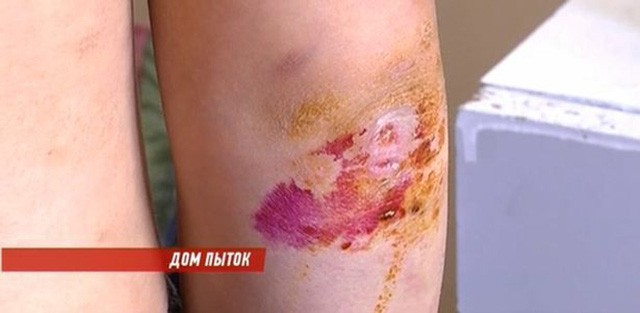 Giao các con cho vợ kế, bố phải bật khóc khi nhìn thấy tình trạng của con ở bệnh viện-1