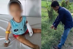 Bé gái 3 tuổi bị người tình của mẹ dùng dao lam cắt đứt gân tay
