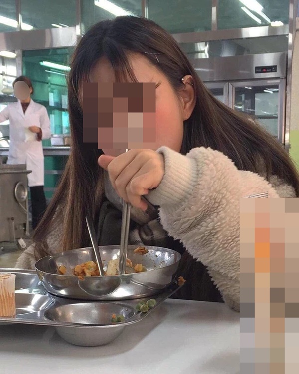 Cô gái 23 tuổi đang ăn thì nôn ra máu, bất ngờ phát hiện ung thư dạ dày chỉ vì 2 thói quen ăn uống phổ biến ở dân văn phòng-4