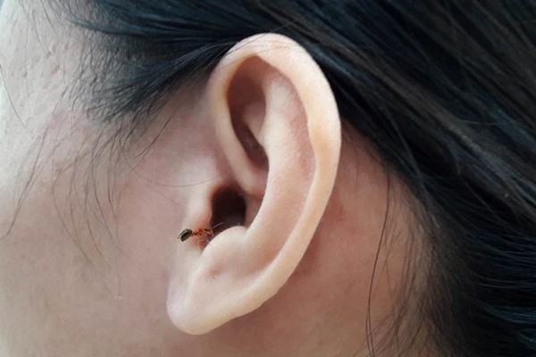 Đang ngủ thì bọ chui vào tai, bạn sẽ làm gì? Bác sĩ lời khuyên 1 việc tuyệt đối không làm nếu không muốn hỏng tai-2