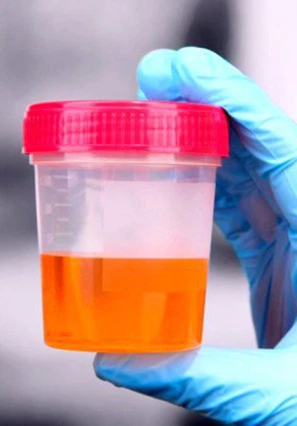 Đi tiểu thấy có triệu chứng này cần phải đi khám ung thư ngay, bỏ vài giây nhưng có thể cứu bạn khỏi căn bệnh nguy hiểm-2