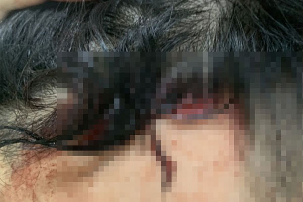 Thái Bình: Nghi án chú họ dụ bé gái 10 tuổi về trang trại, cho tiền mua kem để xâm hại-1