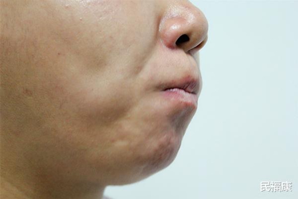 Bỗng thấy miệng xuất hiện 3 điều lạ nghĩa là ung thư đã hình thành, bạn nên đi khám khẩn cấp-2