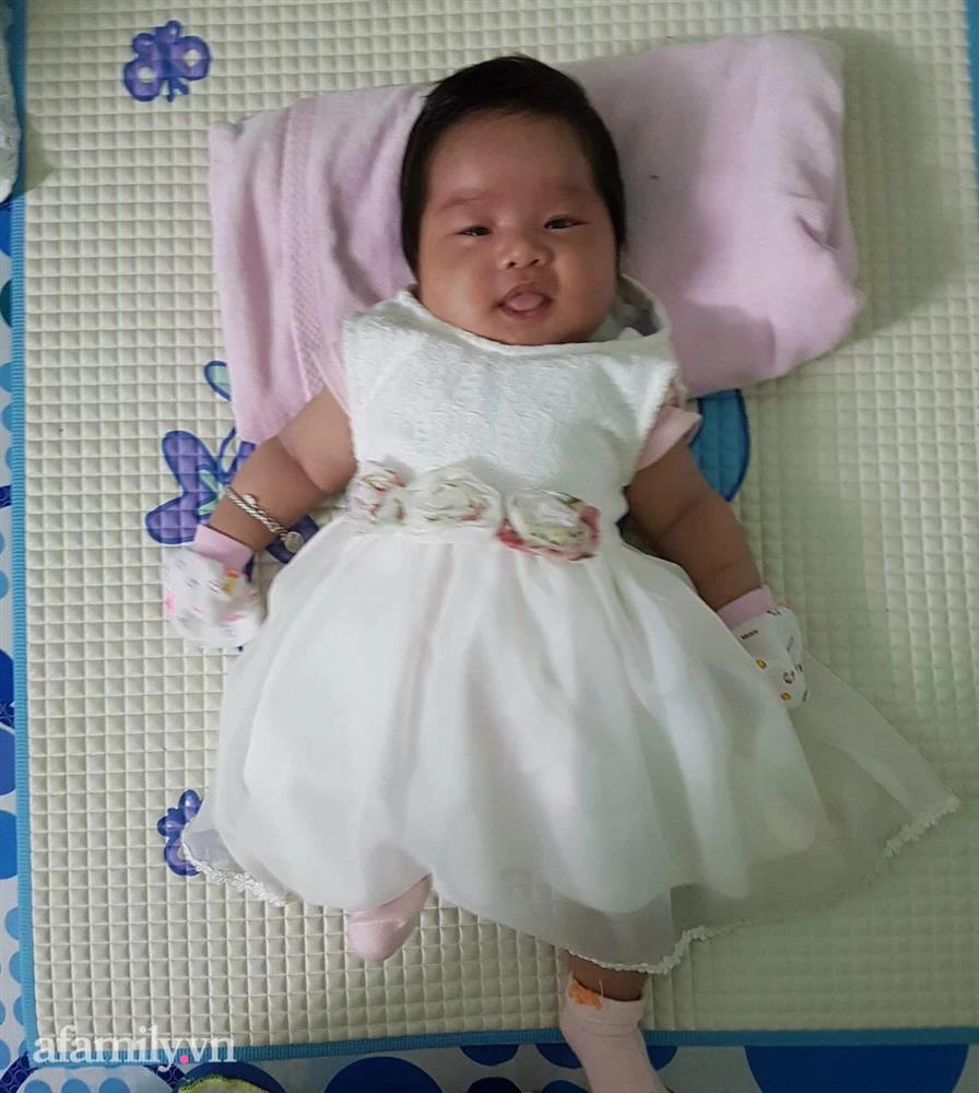 Vừa sinh xong, mẹ bỉm khóc như mưa vì sợ bị nhầm con do bé quá xấu, 4 năm sau diện mạo cô bé thay đổi ngỡ ngàng-2