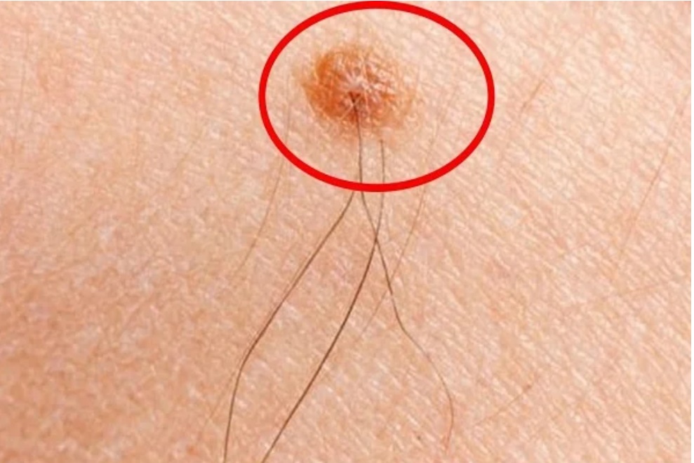 Dù là nam hay nữ, có 4 vị trí lông càng mọc nhiều càng phát tài, phú quý tự tìm đến-1