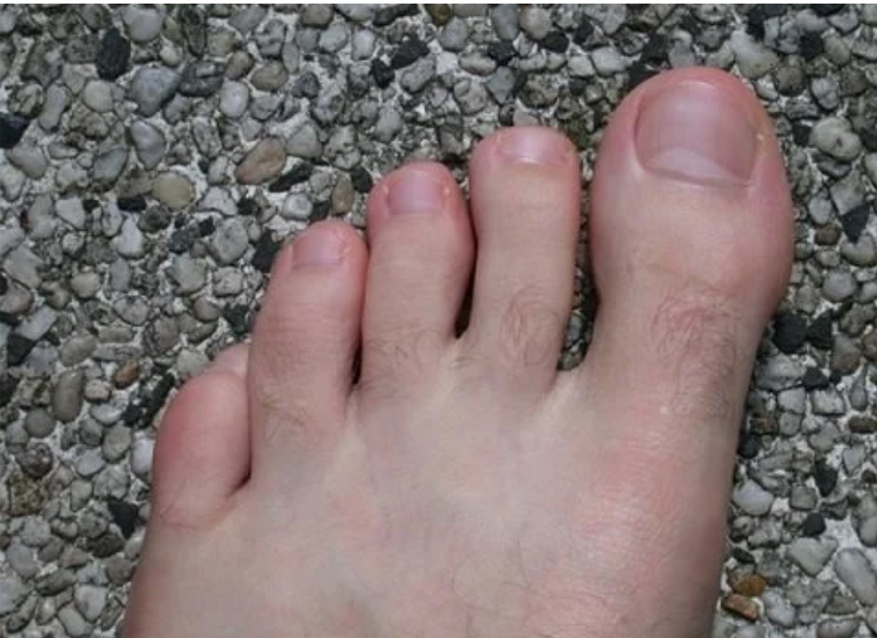 Dù là nam hay nữ, có 4 vị trí lông càng mọc nhiều càng phát tài, phú quý tự tìm đến-2