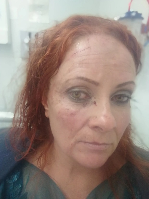 Mẹ ruột và con gái choảng nhau ngay trong lễ cưới, kết cục đôi bạn trẻ trải qua đêm tân hôn trong tù còn thiệt hại thêm một thứ nghe đã thấy tiếc-3