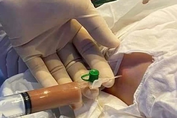 Gần 6.000 ca COVID-19 mới, Hà Nội vượt mốc 1,5 triệu người nhiễm-1