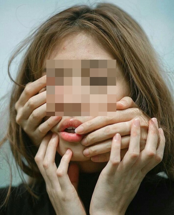 Nữ nhân viên văn phòng 23 tuổi đột nhiên đau tai, liệt mặt sau khi tăng ca về khuya, bác sĩ cảnh báo người trẻ nên cẩn trọng trong thời tiết giao mùa-3