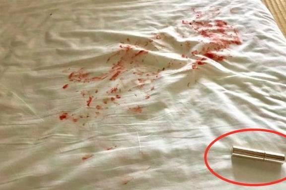 Đi chợ có 10 phút, vừa mở cửa nhà người mẹ tái mặt khi thấy con nằm trên vũng máu”, nhìn kỹ hơn mới thở phào nhẹ nhõm-2