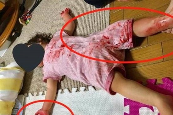 Đi chợ có 10 phút, vừa mở cửa nhà người mẹ tái mặt khi thấy con nằm trên “vũng máu”, nhìn kỹ hơn mới thở phào nhẹ nhõm