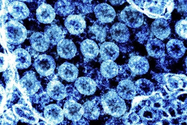 Các biến thể mới của virus SARS-CoV-2 có thực sự đáng quan ngại?-1