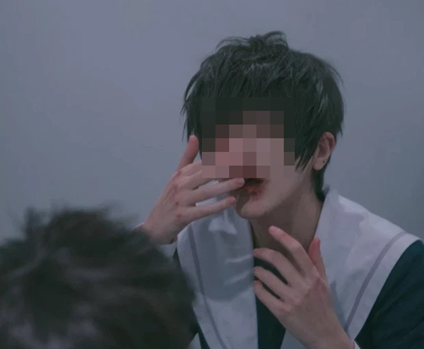 Chàng trai 27 tuổi bỗng mọc mụn khắp mặt, không ngờ nhiễm virus HPV chỉ vì 1 hành động nhỏ trong khách sạn khi đi công tác-4