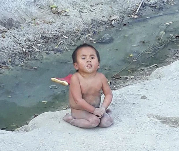 Em bé Mường Lát bị liệt 2 chân và sự thay đổi kỳ diệu sau 5 năm được nhận nuôi-1