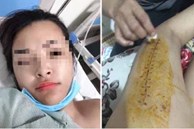 Vụ người phụ nữ khuyết tật bị gãy xương đùi khi trị liệu ở Hà Nội: Đã có kết quả giám định