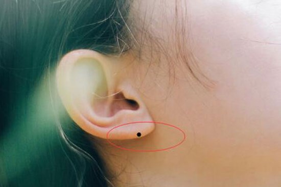 Ai sở hữu 1 trong 3 nốt ruồi ở những vị trí này, tương lai kiếm được khối tài sản to lớn, của ăn của để hưởng được mấy đời