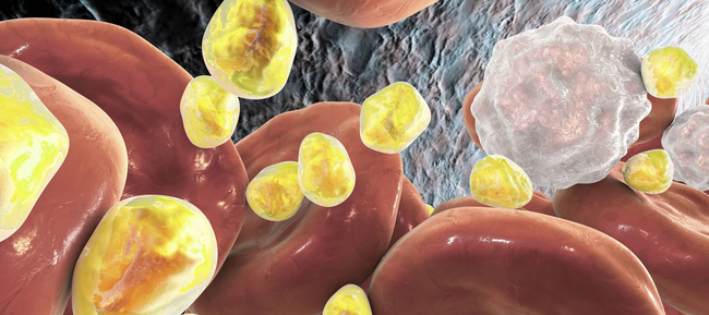 Người có máu nhớt dễ bị cục máu đông, nếu thấy dù 1 trong 3 biểu hiện này khi ngủ dậy, coi chừng tuổi thọ bị đe dọa-1