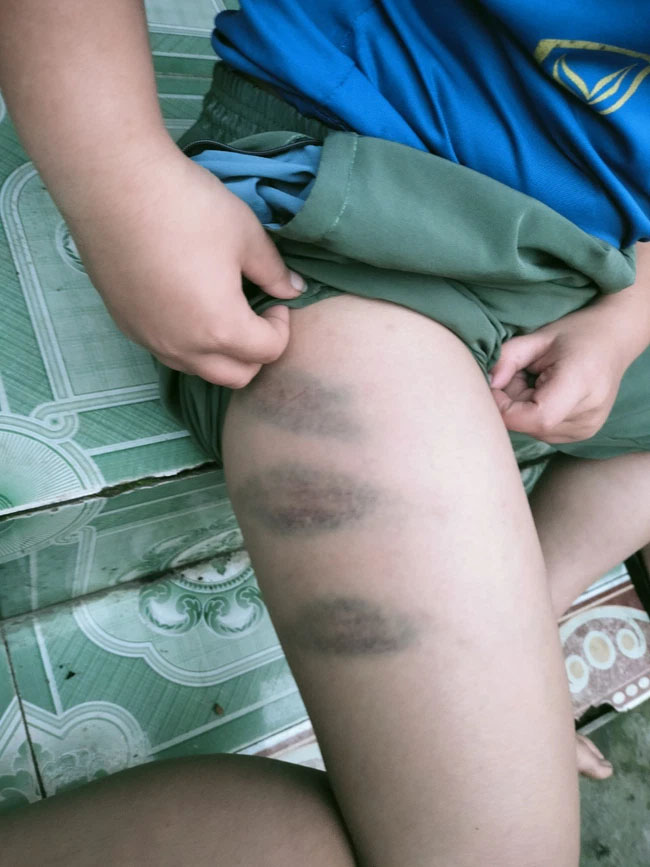 Người phụ nữ tố chồng cũ và vợ mới bạo hành 2 con riêng-1