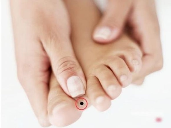 4 vị trí nốt ruồi ở chân là điềm báo mang đến may mắn, ai sở hữu dễ giàu sang, cuộc sống ngập trong vinh hoa phú quý-1