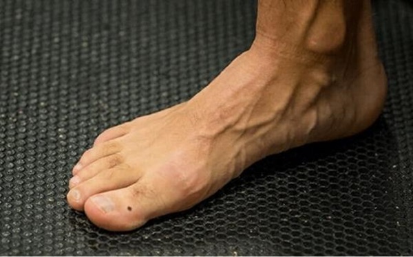 4 vị trí nốt ruồi ở chân là điềm báo mang đến may mắn, ai sở hữu dễ giàu sang, cuộc sống ngập trong vinh hoa phú quý-2