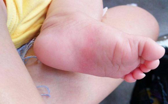 Trên cơ thể có một công tắc thông minh, chạm vào nhiều hơn có thể cải thiện chỉ số IQ, nhưng nhiều bậc cha mẹ chưa bao giờ chạm vào nó-1