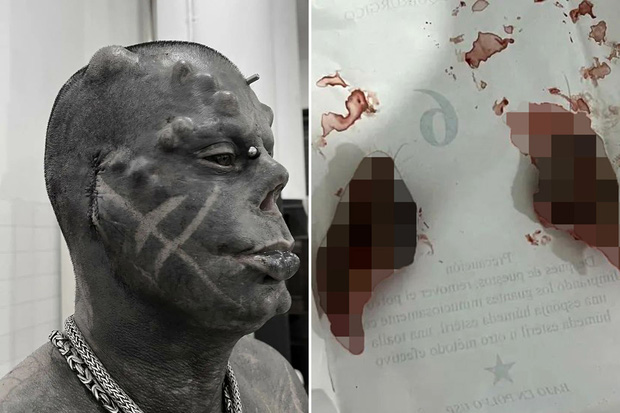 Nổi tiếng vì biến đổi cơ thể giống quỷ Satan, người đàn ông cắt luôn đôi tai để ăn mừng quê nhà gỡ lệnh đeo khẩu trang-1