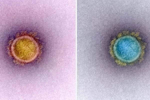 Biến chủng mới tiết lộ kết cục của đại dịch Covid-19-4