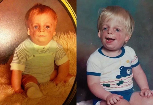 Chàng trai mặt chim bị bố mẹ chối bỏ tận 2 lần vì quá xấu xí, 30 năm sau khiến tất cả ghen tỵ với cuộc đời viên mãn bên người vợ xinh đẹp-1