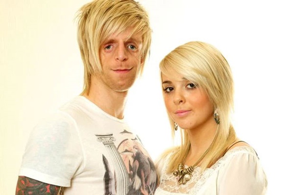 Chàng trai mặt chim bị bố mẹ chối bỏ tận 2 lần vì quá xấu xí, 30 năm sau khiến tất cả ghen tỵ với cuộc đời viên mãn bên người vợ xinh đẹp-6