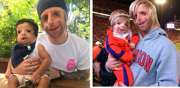 Chàng trai mặt chim bị bố mẹ chối bỏ tận 2 lần vì quá xấu xí, 30 năm sau khiến tất cả ghen tỵ với cuộc đời viên mãn bên người vợ xinh đẹp-8