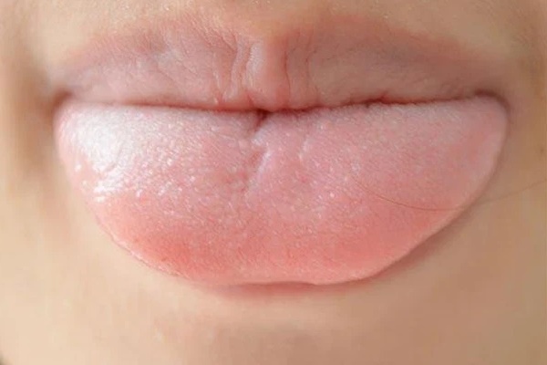 Điểm danh 3 thủ phạm gây dậy thì sớm ở trẻ: Điều số 2 rất nhiều bậc phụ huynh xem thường, không để ý-4