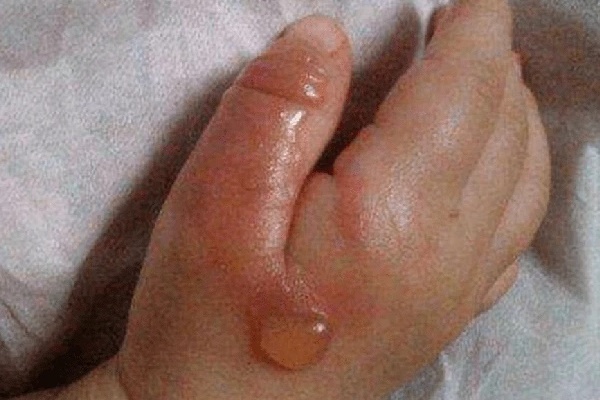 Một thoáng bất cẩn của người cha gây họa cho con trai nhỏ-1