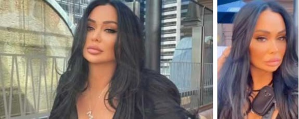 Ngôi sao TikTok bị tạt axit khi đang phát trực tiếp, hàng ngàn người xem nghe rõ tiếng la hét hoảng loạn, cầu xin nước để đỡ bỏng rát-1