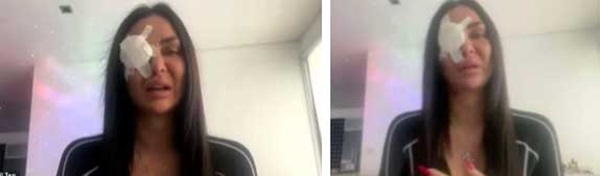 Ngôi sao TikTok bị tạt axit khi đang phát trực tiếp, hàng ngàn người xem nghe rõ tiếng la hét hoảng loạn, cầu xin nước để đỡ bỏng rát-3