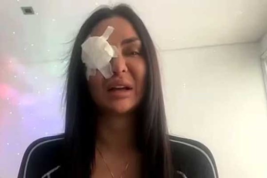 Ngôi sao TikTok bị tạt axit khi đang phát trực tiếp, hàng ngàn người xem nghe rõ tiếng la hét hoảng loạn, cầu xin nước để đỡ bỏng rát