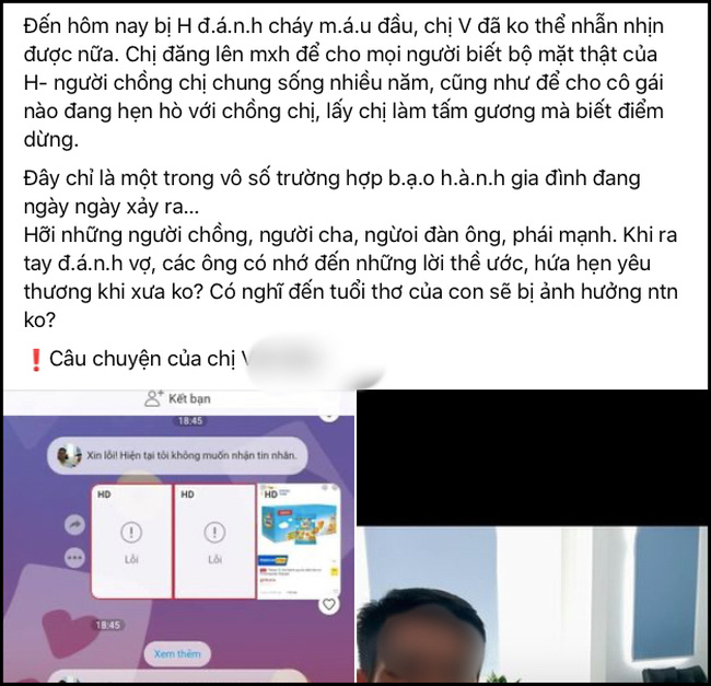 Chồng ngoại tình còn đánh vợ chảy máu đầu be bét, dân mạng đồng loạt thúc giục: Chạy ngay đi khi thấy bức ảnh cô một mình ôm con-1