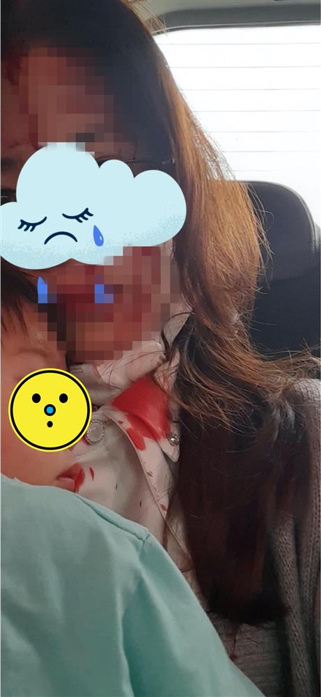 Chồng ngoại tình còn đánh vợ chảy máu đầu be bét, dân mạng đồng loạt thúc giục: Chạy ngay đi khi thấy bức ảnh cô một mình ôm con-2