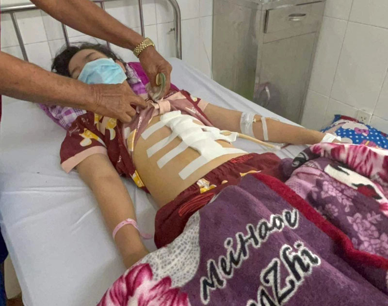 Tin thêm vụ cha dượng đánh con riêng của vợ bị dập lách, gãy xương sườn-1