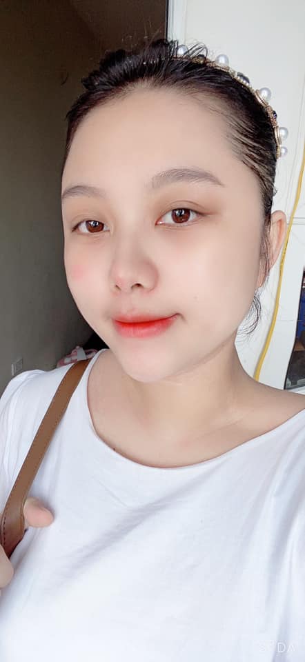 Vừa sinh con xong thì phát hiện mắc ung thư và phải tháo bỏ một chân, mẹ 9x khiến nhiều người ngưỡng mộ: Còn thở là còn hạnh phúc, còn sống là còn chiến đấu-9