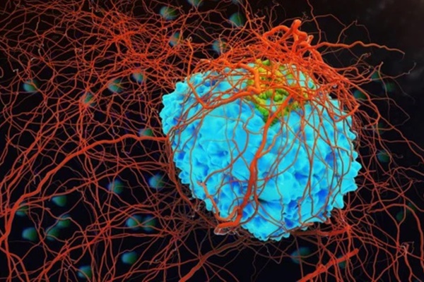 Ai cũng có tế bào ung thư trong cơ thể, nhưng chỉ có 7 kiểu người có thể kích hoạt ung thư, khả năng mắc bệnh cao hơn hẳn người khác-1