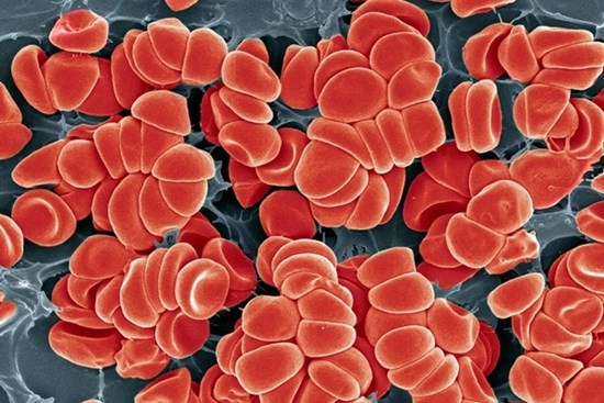 Nguy cơ đông máu bất thường hậu Covid-19