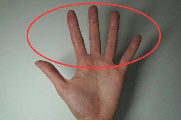 Có 3 cách tự kiểm tra sức khỏe phổi tại nhà, nếu có biểu hiện 1 chậm, 2 nhanh, 3 hơn thì cần đi khám phổi càng sớm càng tốt-2