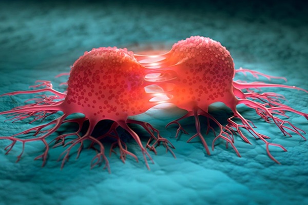 6 loại ung thư thích nhắm vào đàn ông hơn là phụ nữ, tốt nhất bạn hãy chuẩn bị ngay từ bây giờ-6