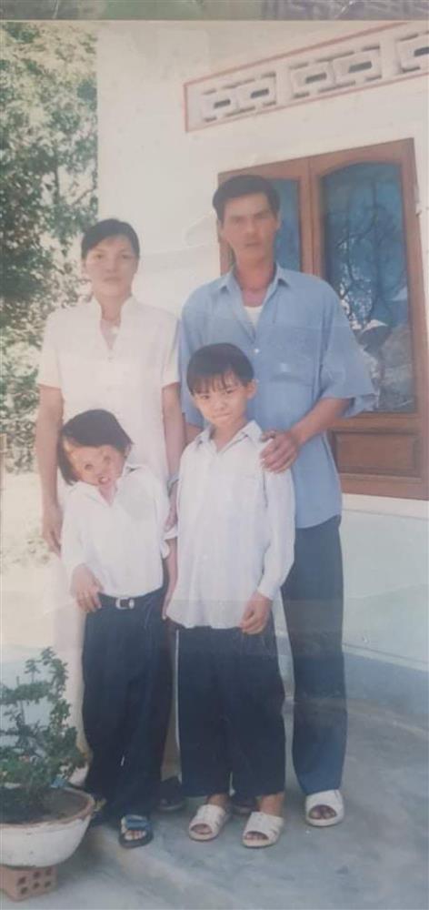 Bé trai 6 tháng rơi vào bếp lửa, tuổi thơ cô độc và bước ngoặt không ngờ cách đây 6 năm-1