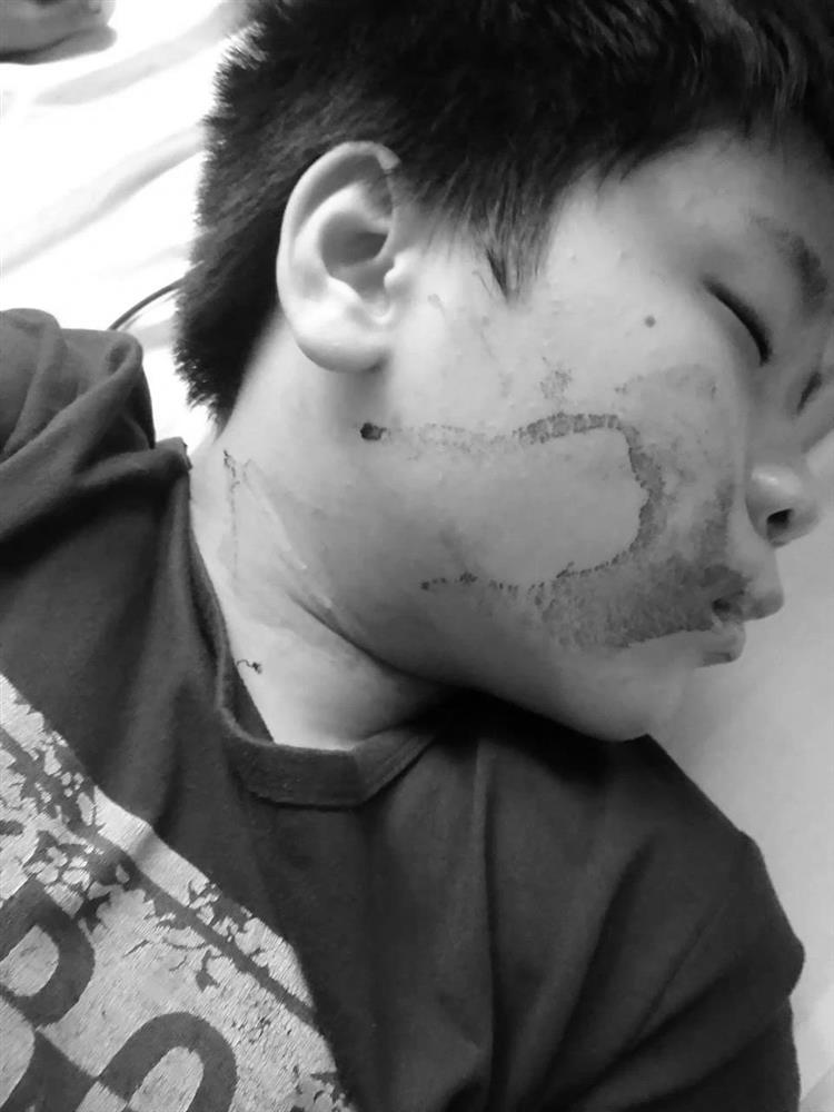 Hai mẹ con cùng mắc bệnh hiểm nghèo chia nhau từng suất cơm, ròng rã nhiều năm bám bệnh viện giành giật sự sống-4