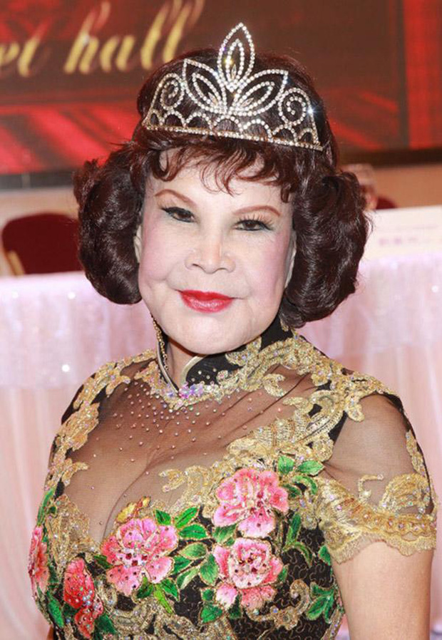 Thảm họa dao kéo showbiz: Làm tiểu tam bên cạnh đại gia đáng tuổi bố, điên cuồng thẩm mỹ cũng vì níu giữ nhân tình-4