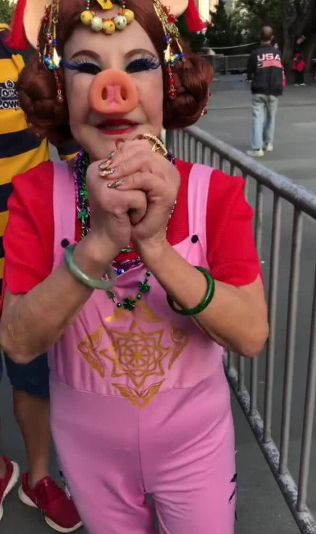 Thảm họa dao kéo showbiz: Làm tiểu tam bên cạnh đại gia đáng tuổi bố, điên cuồng thẩm mỹ cũng vì níu giữ nhân tình-8