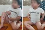 Vụ cháu bé 4 tuổi bị đánh bằng cán chổi, móc áo vì lười ăn: Tạm giữ dì ruột-4